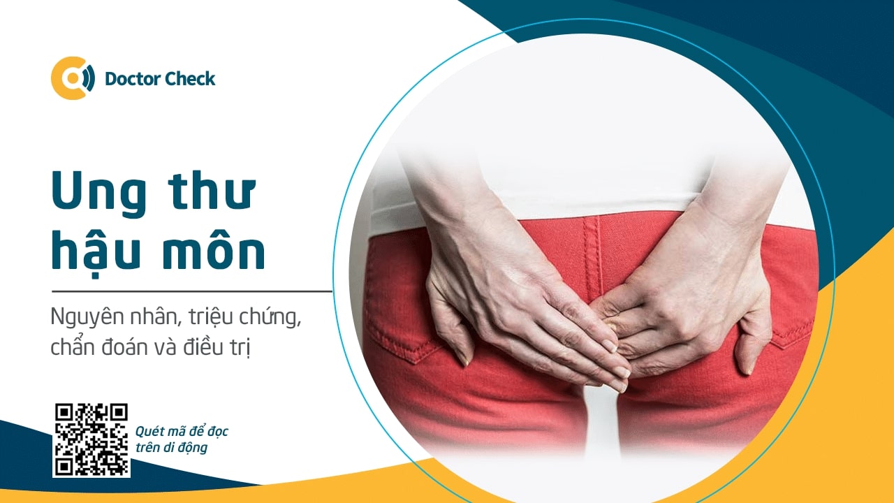 Ung thư hậu môn: Nguyên nhân, triệu chứng, chẩn đoán và điều trị